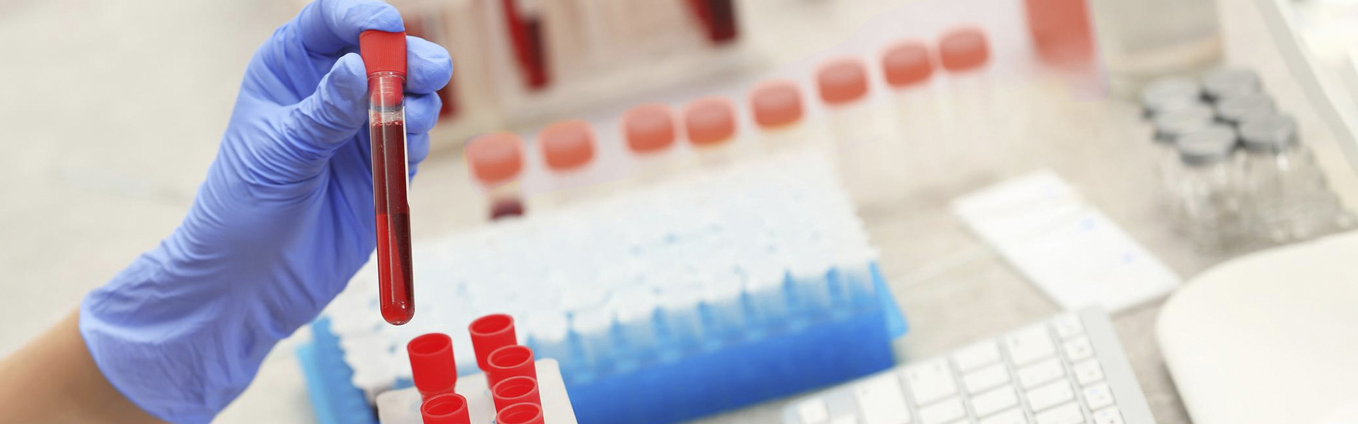 img shu slider sangre hematologia
