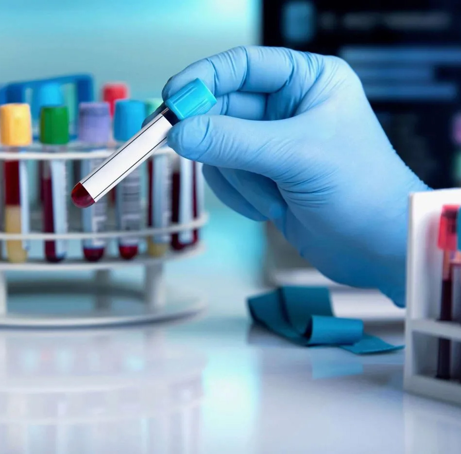 sangre laboratorio shu hematologia